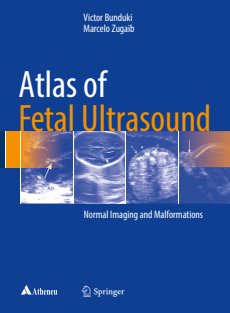 Atlas of Fetal Ultrasound  Normal Imaging and Malformations