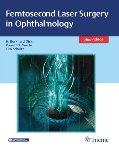 Femtosecond Laser Surgery in Ophthalmology By H. Burkhard Dick Ronald D. B079B7FK5T Thieme 2018-02-07.PDF