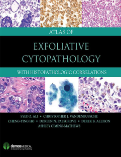 RRR-Ali Md Frcpath Fiac, Syed Z. - Atlas Of Exfoliative Cytopathology_ With Histopathologic Correlations Ali Md Frcpath Fiac, Syed Z.-demosMEDICAL (2017)