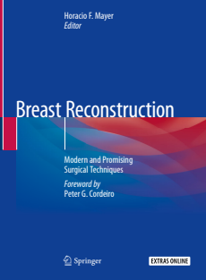 Breast Reconstruction Modern and Promising Surgical Techniques