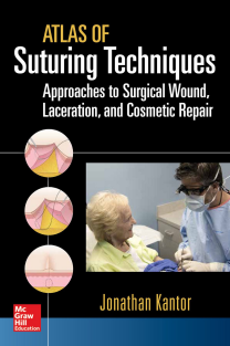 RRR-Jonathan Kantor - Atlas of Suturing Techniques_ Approaches to Surgical Wound, Laceration, and Cosmetic Repair-McGraw-Hill Education _ Medical (2016)