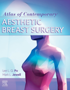 Atlas of Contemporary Aesthetic Breast Surgery A Comprehensive Approach 1st Edition