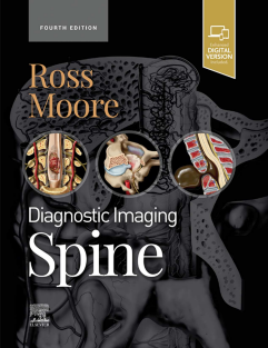 Diagnostic Imaging Spine 4th Edition