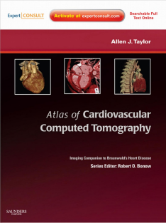 Atlas_of_Cardiovascular_Computed_Tomography_Imaging_Companion_to