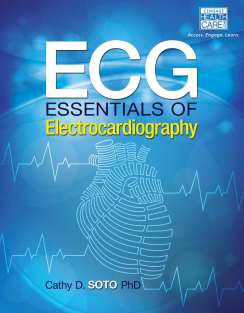 ECG Essentials of Electrocardiography