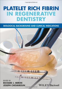 Platelet Rich Fibrin in Regenerative Dentistry Biological Backgroundand Clinical Indications