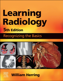 Learning Radiology Recognizing the Basics 5th Edition 2023