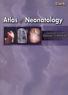 ATLAS OF NEONATOLOGY Clark