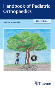 Handbook of Pediatric Orthopaedics