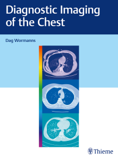 Diagnostic Imaging of the Chest 2020