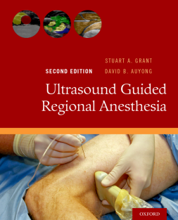 Ultrasound Guided Regional Anesthesia.PDF