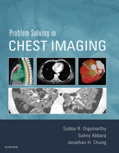 Problem Solving in Chest Imaging