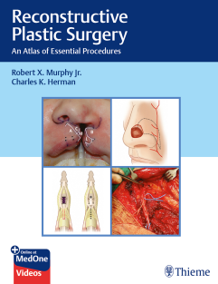 Reconstructive Plastic Surgery An Atlas of Essential Procedures 1st Edition