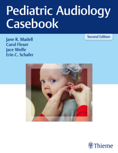 Pediatric Audiology Casebook By Jane R. Madell Carol Flexe 1626234035  Thieme - 2019