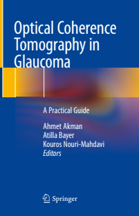 Optical Coherence Tomography in Glaucoma a practical guide 