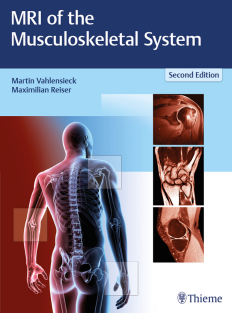 MRI of the Musculoskeletal System