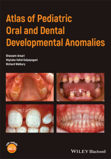 Atlas of Pediatric Oral and Dental Developmental Anomalies 1st Edition