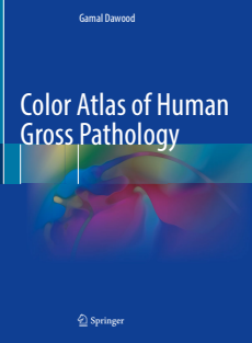 Color Atlas of Human Gross Pathology 1st ed 2022 Edition