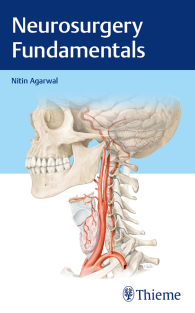 Neurosurgery Fundamentals