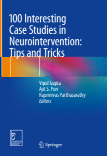 100 Interesting Case Studies in Neurointervention Tips and Tricks 1st ed. 2019 Edition, by Vipul Gupta