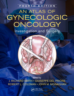 An Atlas of Gynecologic Oncology Investigation and Surgery