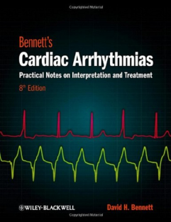 bennetts cardiac arrhythmias