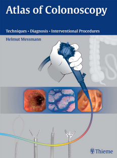 Atlas of Colonoscopy Examination Techniques and Diagnosis