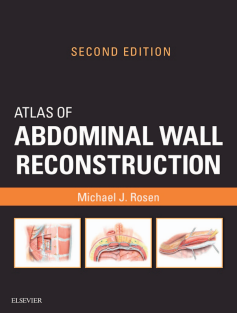 Atlas of Abdominal Wall Reconstruction