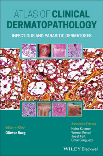 RRR-Günter Burg (editor) - Atlas of Clinical Dermatopathology_ Infectious and Parasitic Dermatoses-Wiley-Blackwell (2021)