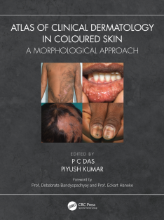 Atlas_of_Clinical_Dermatology_in_Coloured_Skin_A_Morphological_Approach