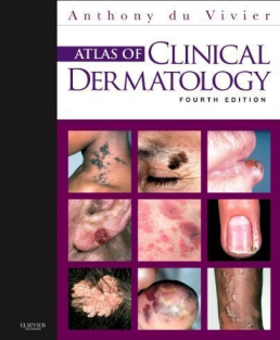 Du Vivier Atlas of Clinical Dermatology