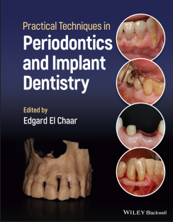 Practical Techniques in Periodontics and Implant Dentistry 1st Edition