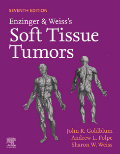 Enzinger and Weiss's Soft Tissue Tumors 7th Edition