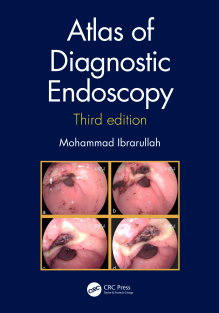 RRR-Mohammad Ibrarullah - Atlas of diagnostic endoscopy (2020)