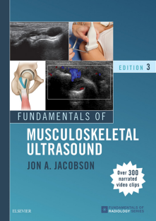 fundamentals of musculoskeletal ultrasound