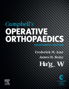 Campbell's Operative Orthopaedics, Volume I