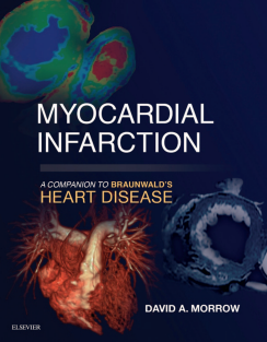 Myocardial infarction  a companion to Braunwald’s heart disease