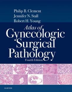 Atlas of Gynecologic Surgical Pathology 4th Edition