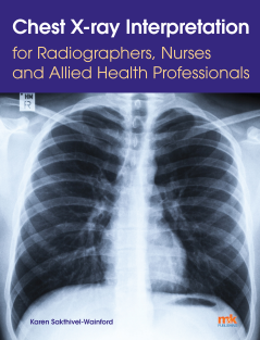 Chest X ray Interpretation for Radiographers Nurses and Allied health professionals