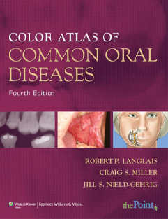 color  of common oral diseases