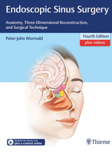 Endoscopic Sinus Surgery Anatomy, Three-Dimensional Reconstruction, and Surgical Technique