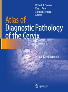 RRR-Robert A. Soslow (editor)_ Kay J. Park (editor)_ Simona Stolnicu (editor) - Atlas of diagnostic pathology of the cervix _ a case-based approach-Springer (2021)