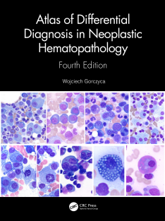 Atlas of Differential Diagnosis in Neoplastic Hematopathology 4th Edition