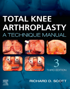 med_Surgery_+_scn_indx0323710654_Total_Knee_Arthroplasty_By_Richard