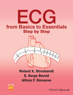 ECG from Basics to Essentials step by step