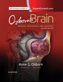 Osborn's Brain.PDF