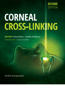 Corneal Cross-Linking