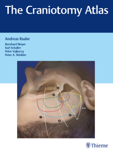 The Craniotomy Atlas 1st Edition