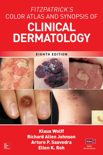 Fitzpatricks Color Atlas and Synopsis of Clinical Dermatology, 8th Edition (Klaus Wolff, Richard Allen Johnson etc.)