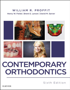 Contemporary Orthodontics 6th Edition